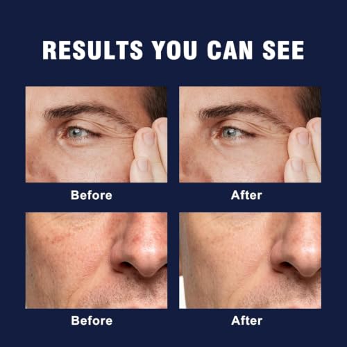 Men's 6-in-1 Face Cream - Hydrating, Anti-Aging & Soothing - 1.7 Fl Oz Pack of 3