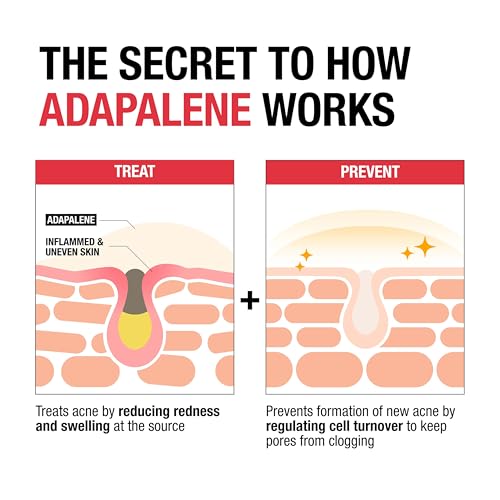Neutrogena Adapalene 0.1% Acne Gel Treatment - 1.6 oz for Clear Skin