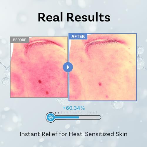 Hydrating Exosome Face Serum with Squalane & Niacinamide – 30ml