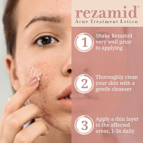 Acne Spot Treatment Lotion with Sulfur & Resorcinol for Oily Skin - 2oz