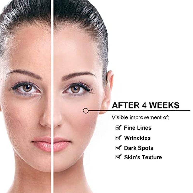 Elitzia Skin Care Carbon Peel Gel Rejuvenation Black Face Doll Facial Skin Deep Cleaning Cream 10.15fl.oz ETBDF30
