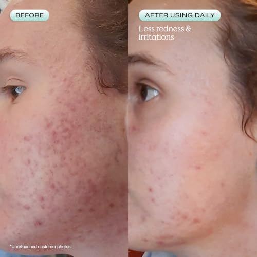 KraveBeauty Great Barrier Relief Face Serum 1.52 Fl Oz for Dry Sensitive Skin