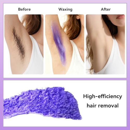 SHAPE CONCEPT Chin Strap for Sleeping 317 Medium Compression Double Chin Reducer and Chin Strap for Snoring