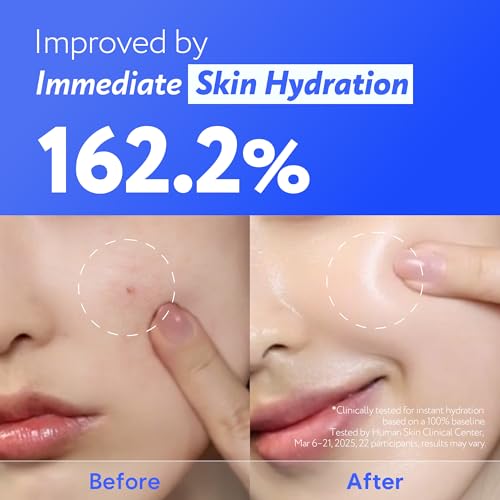 Coconut Water Glow Calming Serum | Hydrating & Soothing Serum with Panthenol, Niacinamide & Cica | Centella Asiatica | Barrier Repair for Sensitive Skin | Korean Skin Care (30ml / 1.01 fl oz)