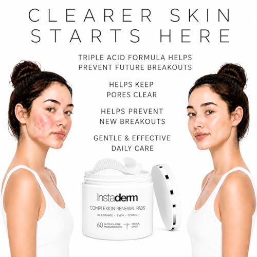 Acne Treatment Pads with Salicylic, Glycolic & Lactic Acid - Exfoliating Facial Pads for Blackheads & Oily Skin