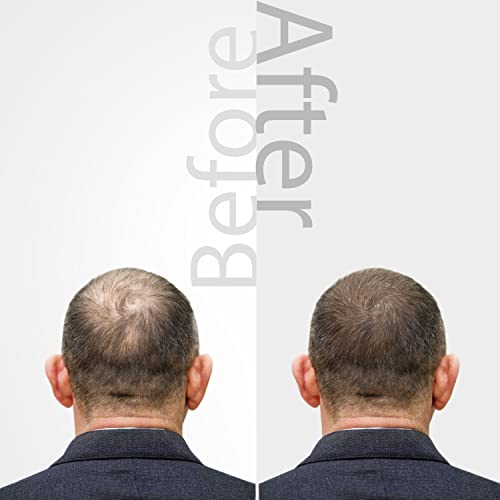 Ozonized Olive Oil Hair Serum for Thicker, Fuller Hair & Scalp Care