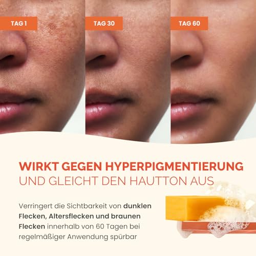 PLANTIFIQUE Kojic Acid Soap for Hyperpigmentation - Turmeric Soap 2 Bars & Kojic Acid and Turmeric Cleansing Pads 60