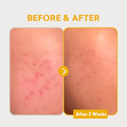 TIRTIR Pure Vitamin C 24% Serum 30ml + SOS Serum 50ml