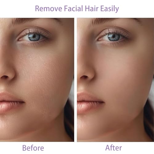 Tuokiy Facial Hair Remover for Women Purple + 2 Replacement Heads - Painless & Portable