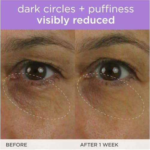 TATCHA The Brightening Eye Cream | Brightening & Dark Circle Reduction with Vitamin C for Bight, Firm Undereyes, 15 ml / 0.5 fl. oz.