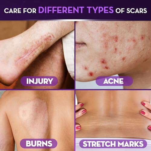 Cicatricure Advanced Scar Gel 2 oz - Proven Results in 2 Weeks - Pack of 1