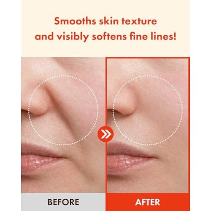 It'S SKIN Retinoidin Cream - Retinol Anti Aging Face Moisturizer - Smooth Wrinkles & Fine Lines - Firming & Moisturizing with Adenosine, Hyluronic Acid, Peptides, Niacinamide and Ceramide, 3.38 oz.