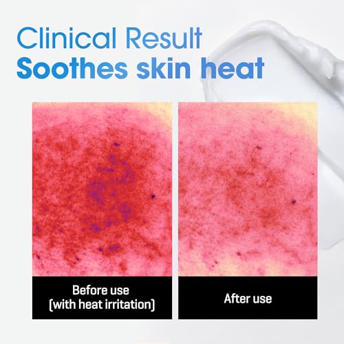 SOME BY MI AHA BHA PHA 30 Days Miracle Acne Clear Body Cleanser & Beta-Panthenol Repair Body Cream