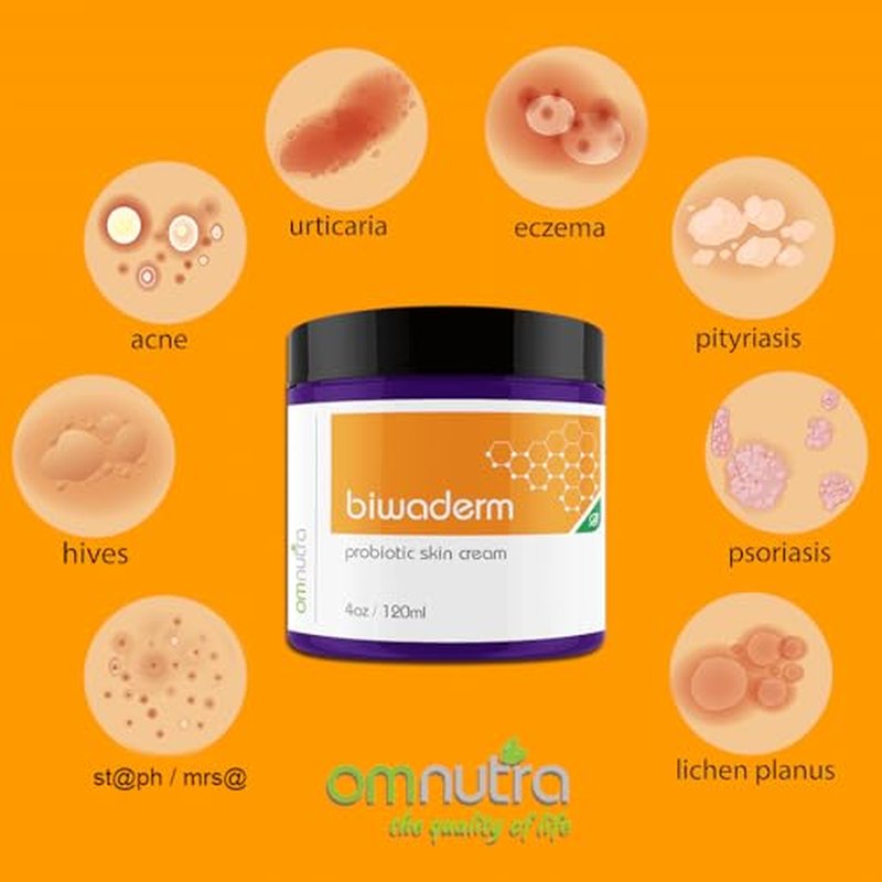 Biwaderm Probiotic Skin Cream - 4OZ Organic Based Topical Probiotics for Skin Care Eczema Treatment Psoriasis Treatment for Folliculitis Treatment Pure Aloe Vera Gel 4oz