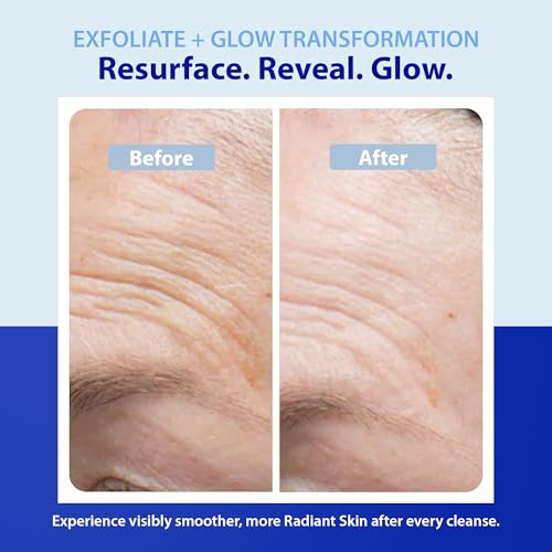 Gentle Exfoliating Face Wash with Glycolic Acid for Radiant Skin - 6 oz