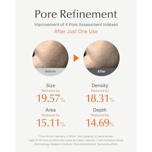 SU:M One Minute Clay Mask - Pore Cleanser & Hydrating 2-in-1 Korean Face Mask and Facial Cleanser for Blackheads, Exfoliation & Smooth Skin, 5.07 fl oz