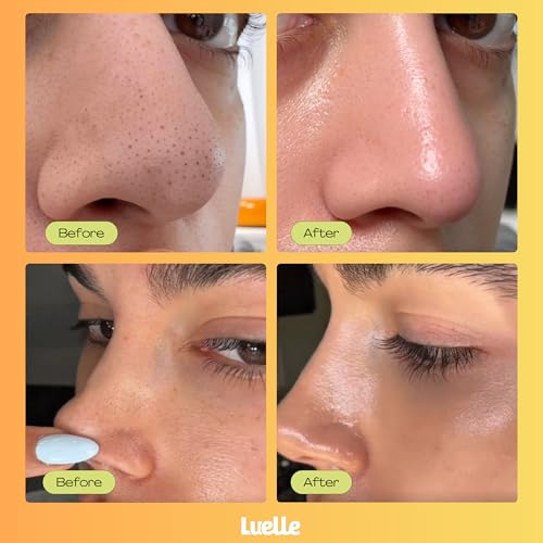 Blackhead Remover Pore Strips & Pore Minimizer Serum Bundle ? 2-Step Pore Deep Cleansing & Pore Refine System for Smooth, Clear Skin