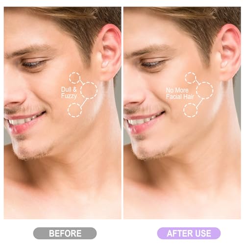 Rechargeable Sonic Dermaplane Razor for Women Face - Lavender - Safe Exfoliation & Skin Smoothing