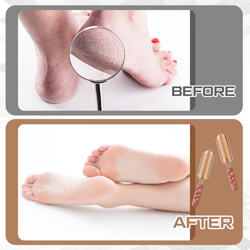 Rose Gold 14-Piece Foot File Pedicure Tool Set | Rustproof Callus Remover