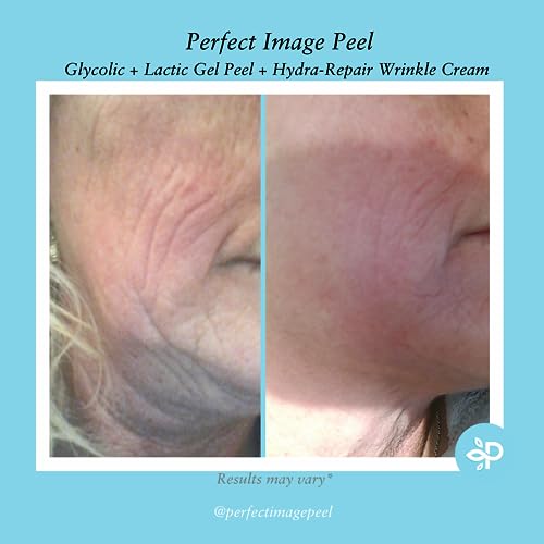 Glycolic Gel Peel 10% with Retinol & Green Tea Extract - Enhanced Skin Exfoliation