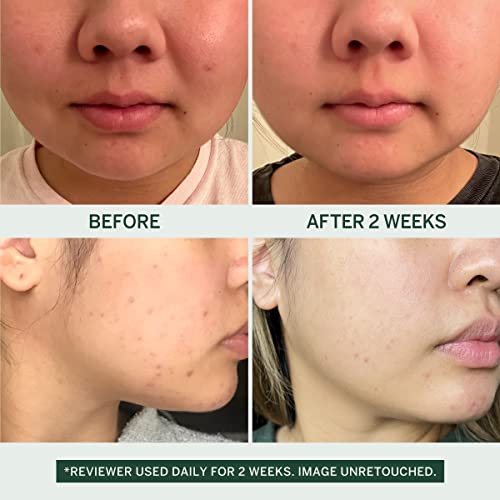 Dr.Jart+ Vital Hydra Solution Jelly Bear Korean Overnight Lip Mask with Hyaluronic Acid | Korean Skin Care, 0.59 Oz