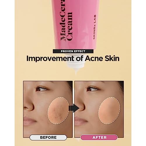 SKINRxLAB Made Cera Cream - Acne & Redness Relief Face Moisturizer, Sebum Control, Improving Skin Barrier with Ceramide and Madecassoside, Anti-Aging and Pore Minimizing Face Cream, 1.69 + 0.5 fl.oz.