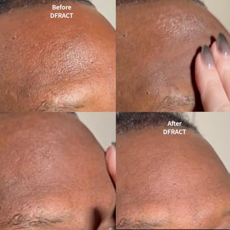 Blur Balm | Anti-Shine Without Makeup | On-Camera Soft-Focus Skin Blurring | Glare & Texture Reduction | HD, 4K?10K Video Streaming & Photography | 1oz