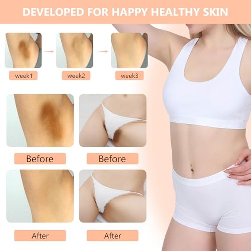 100ml Skin Bleaching Cream - Dark Spots Remover Lightening Cream & Uneven Tone Nourishing Formula Bleaching Intimate Areas & Underarms Inner Thigh, Bikini Line, Armpit Knees Elbows for All Skin Types
