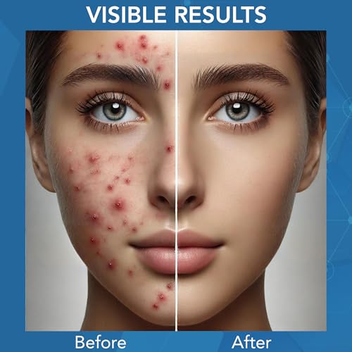 NOVEHA Facial Cleanser For Acne - Hypochlorous Acid Spray - Irritation, Redness & Breakouts Relief - Ideal for Active Teenage & Adult Athletes Post-Workout - Safe for Multiple Daily Uses - 8 oz