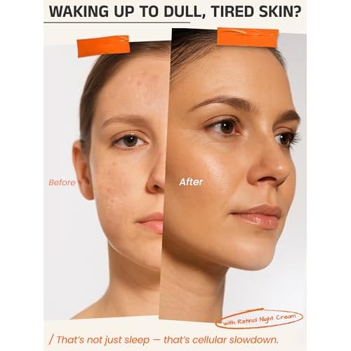 Retinol Night Cream with Vitamin A, Matrixyl 3000, Vitamin C & Daisy Extract ? Anti-Aging Night Treatment for Fine Lines, Skin Tone & Wrinkles ? Non-Irritating ? by Eternity Medicine 1oz