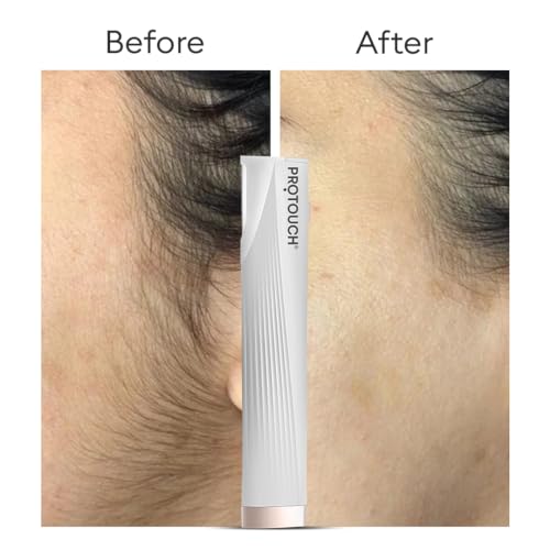 PROTOUCH Electric Dermaplaning Device | Beauty Tool | 2 in 1 Eyebrow & Face Hair Remover with Gentle Exfoliation | Quick, Painless, Smoother & Glowing Skin | 3 Attachment | Easy & Safe to Use