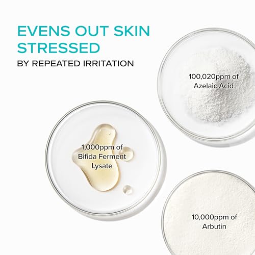 Azelaic Acid Serum 10% for Blemish-Prone Skin - Lightweight, Soothing & Pore Refining