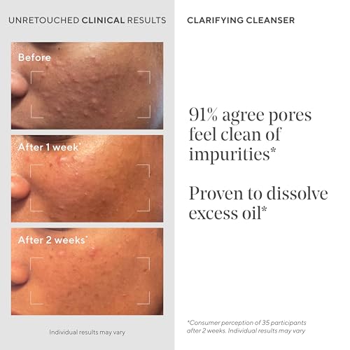 Murad Acne Control Clarifying Cleanser Salicylic Acid 16.9 Fl Oz