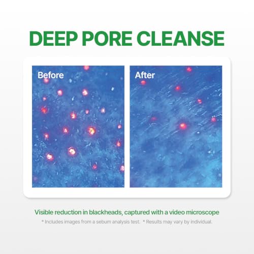MAKE P:REM Safe Me Relief Moisture Cleansing Oil 7.1 fl oz (210 mL) – Cleansing Oil Variation