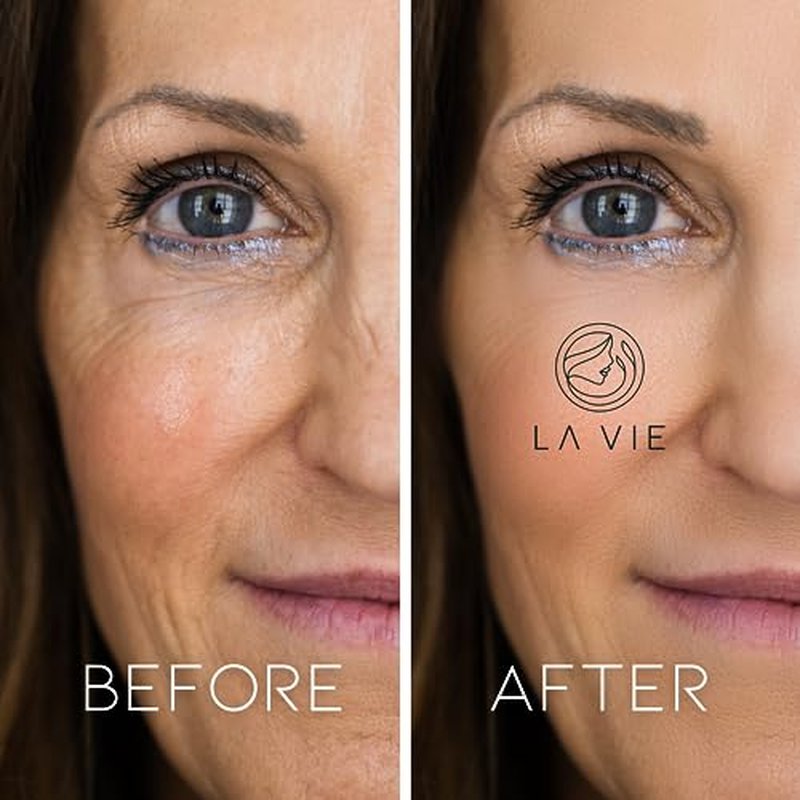 La Vie Anti-Aging Night Cream ? Night Cream for Women Anti-Aging with Niacinamides, Hyaluronic Acid - Retinol Moisturizer Against Wrinkles ? 1.7Fl Oz
