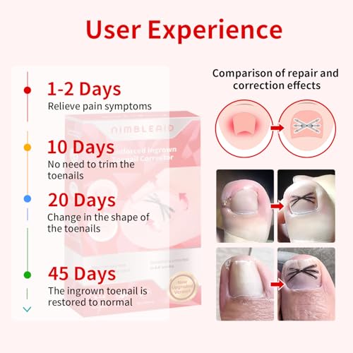 Upgraded Titanium Alloy Ingrown Toenail Corrector with Upgraded 6-Angle Shape,3x Stronger Pull Force,Ingrown Toenail Removal Kit, Ingrown Toenail Treatment for Women and Man (S size - 6 Packs)