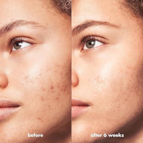 NOW Foods Solutions, Mediterranean Red Clay Powder, Pure Powder for Sensitive Skin Facial Mask, 14-Ounce