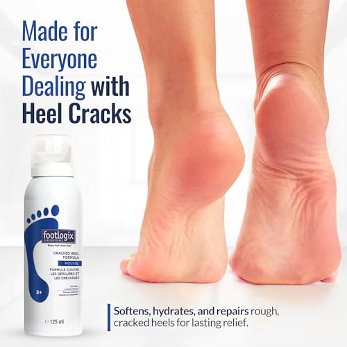 Footlogix Cracked Heel Mousse with Urea & Primrose Oil 4.23oz - Dry, Callused Feet Care