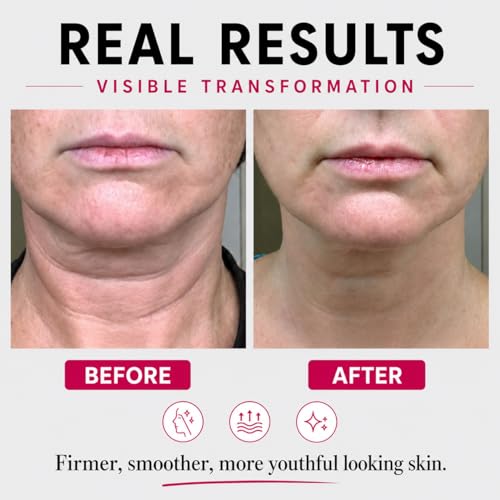 Neck Firming Cream with Retinol & Peptides - 1.7 Fl Oz Pack of 2