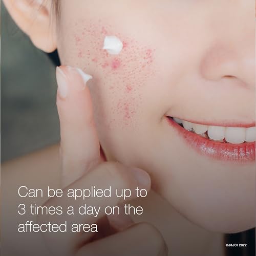 Neutrogena Rapid Clear Stubborn Acne Spot Treatment Gel 10% Benzoyl Peroxide 1 oz Twin Pack