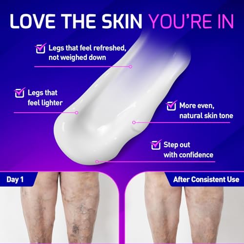 Pharmapulse VARICOSYL Varicose Veins Cream for Legs ? Spider Vein Soothing Leg Cream with Horse Chestnut, Arnica, MSM, Menthol ? Cooling Formula for Tired Heavy Legs ? Non-Greasy, Fast-Absorbing 4oz