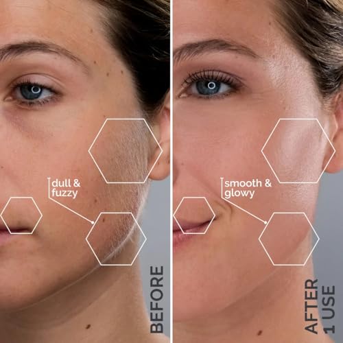 Michael Todd Beauty - Sonicsmooth Pro+ Dermaplaning Blade Refills - 8 Dermaplaning Blades- 2 Month Supply - Device Not Included