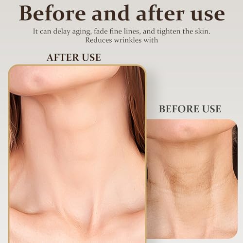 Silicone Chest Wrinkle Pads - Anti-Aging Neck & Chest Line Smoothing (8 Pack)