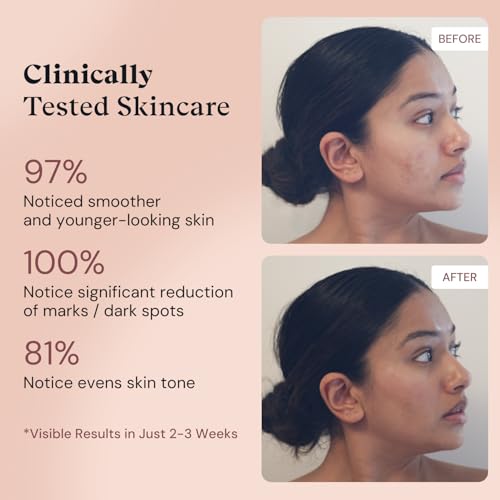 Anti-Aging Retinol Serum for Face with Niacinamide and Prickly Pear Oil - 1oz