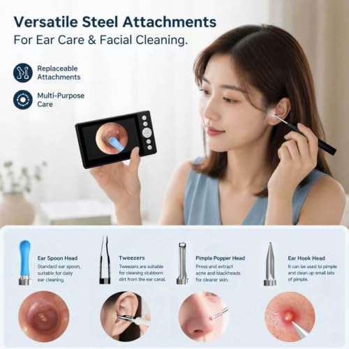 Wireless Ear Otoscope with 4.3-Inch HD Screen and Ear Wax Removal Kit