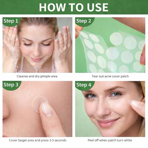 Hydrocolloid Pimple Patches for Face (36ct) ? Invisible 8mm & 12mm Acne Patches for Zits, Pimples & Blemishes, Vegan & Cruelty-Free
