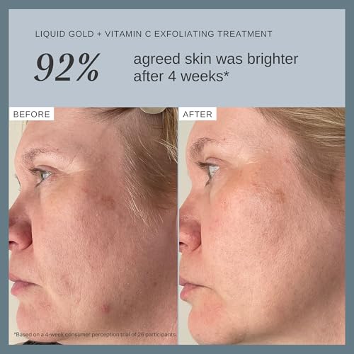 Alpha-H Liquid Gold Exfoliating Treatment with Vitamin C – Brighten & Even Skin Tone