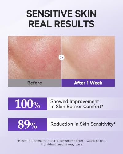 Face Moisturizer for Dry Sensitive Skin with Barrier Support - Hydrating Cream