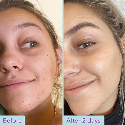 Good Molecules Niacinamide Brightening Toner - Toner for Face with Niacinamide and Arbutin for Skin Tone Balancing- Pore Minimizer, Facial Skin Care
