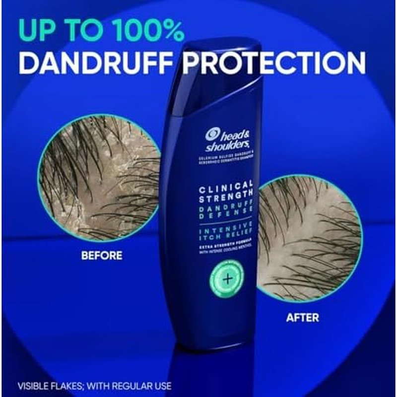 Head & Shoulders Clinical Strength Dandruff Defense 2-in-1 Shampoo + Conditioner, Itch Relief Shampoo, Flake Control, Seborrheic Dermatitis Care, 13.5 Ounce Bottles, Pack of 2